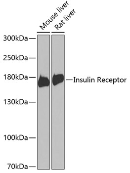 Western blot analysis of various lysates using Insulin Receptor Rabbit pAb (A0005) at 1:1000 dilution.<br/>Secondary antibody: HRP Goat Anti-Rabbit IgG (H+L) (AS014) at 1:10000 dilution.<br/>Lysates/proteins: 25μg per lane.<br/>Blocking buffer: 3% nonfat dry milk in TBST.<br/>Detection: ECL Enhanced Kit (RM00021).<br/>Exposure time: 90s.