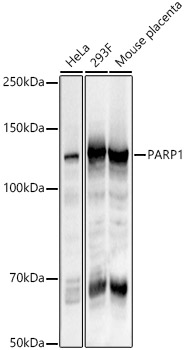 Western blot analysis of various lysates using PARP1 Rabbit pAb (A0010) at 1:1000 dilution.<br/>Secondary antibody: HRP Goat Anti-Rabbit IgG (H+L) (AS014) at 1:10000 dilution.<br/>Lysates/proteins: 25μg per lane.<br/>Blocking buffer: 3% nonfat dry milk in TBST.<br/>Detection: ECL Basic Kit (RM00020).<br/>Exposure time: 1s.