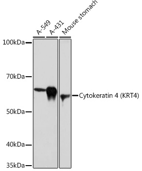 Western blot analysis of various lysates using Cytokeratin 4 (KRT4) (KRT4) Rabbit mAb (A0013) at 1:1000 dilution.<br/>Secondary antibody: HRP Goat Anti-Rabbit IgG (H+L) (AS014) at 1:10000 dilution.<br/>Lysates/proteins: 25μg per lane.<br/>Blocking buffer: 3% nonfat dry milk in TBST.<br/>Detection: ECL Basic Kit (RM00020).<br/>Exposure time: 30s.