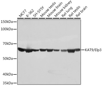 Western blot analysis of various lysates using KAT9/Elp3 Rabbit mAb (A0020) at 1:1000 dilution.<br/>Secondary antibody: HRP Goat Anti-Rabbit IgG (H+L) (AS014) at 1:10000 dilution.<br/>Lysates/proteins: 25μg per lane.<br/>Blocking buffer: 3% nonfat dry milk in TBST.<br/>Detection: ECL Basic Kit (RM00020).<br/>Exposure time: 1s.