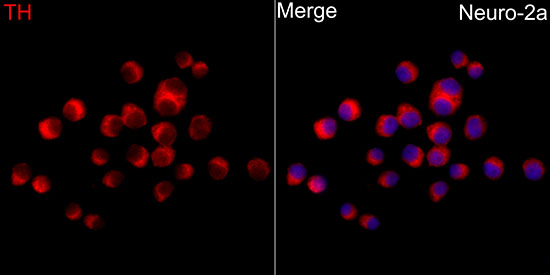 Western blot analysis of lysates from Jurkat cells using Tyrosine Hydroxylase Rabbit pAb(A0028) at 1:3000 dilution.<br/>Secondary antibody: HRP Goat Anti-Rabbit IgG (H+L) (AS014) at 1:10000 dilution.<br/>Lysates/proteins: 25 μg per lane.<br/>Blocking buffer: 3% nonfat dry milk in TBST.<br/>Detection: ECL Basic Kit (RM00020).<br/>Exposure time: 90s.