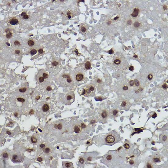 Immunohistochemistry analysis of Formyl-Histone H2B-K108 in paraffin-embedded human liver using Formyl-Histone H2B-K108 Rabbit mAb (A0032) at dilution of 1:100 (40x lens).Perform high pressure antigen retrieval with 10 mM citrate buffer pH 6.0 before commencing with IHC staining protocol.