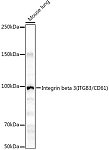 Western blot - Integrin beta 3 (ITGB3/CD61) Rabbit pAb (A0076)