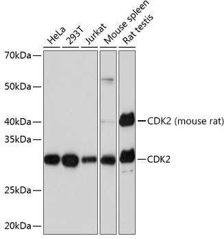[KO Validated] CDK2 Rabbit monoclonal antibody
