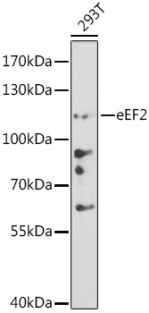 Western blot analysis of lysates from 293T cells, using eEF2 Rabbit pAb (A0099) at 1:500 dilution.<br/>Secondary antibody: HRP-conjugated Goat anti-Rabbit IgG (H+L) (AS014) at 1:10000 dilution.<br/>Lysates/proteins: 25μg per lane.<br/>Blocking buffer: 3% nonfat dry milk in TBST.