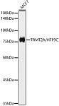 Western blot - TRMT2A/HTF9C Rabbit mAb (A0136)
