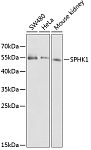 Western blot - SPHK1 Rabbit pAb (A0139)