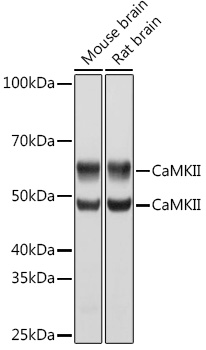CaMK2 delta/CAMK2 gamma Rabbit monoclonal antibody