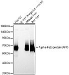 Western blot - Alpha-Fetoprotein (AFP) Rabbit pAb (A0200)