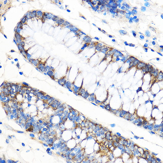 [KO Validated] ATG5 Rabbit polyclonal antibody