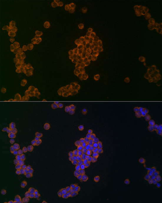 [KO Validated] ATG5 Rabbit polyclonal antibody