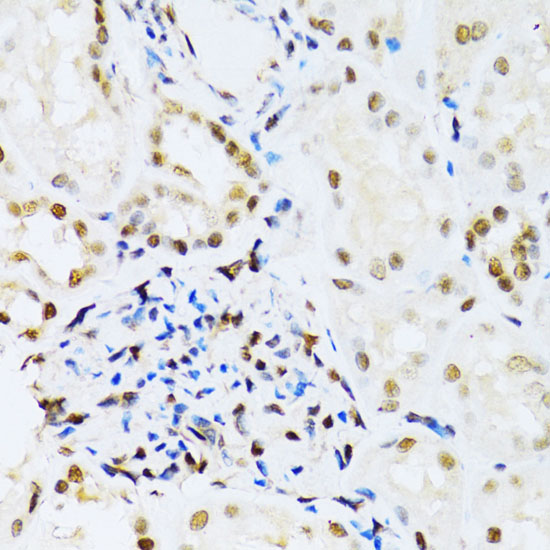 [KD Validated] ERK1 Rabbit polyclonal antibody