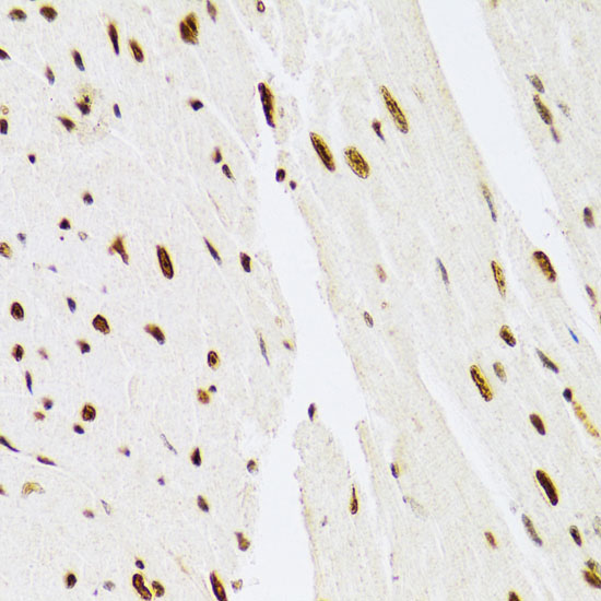 [KD Validated] ERK1 Rabbit polyclonal antibody
