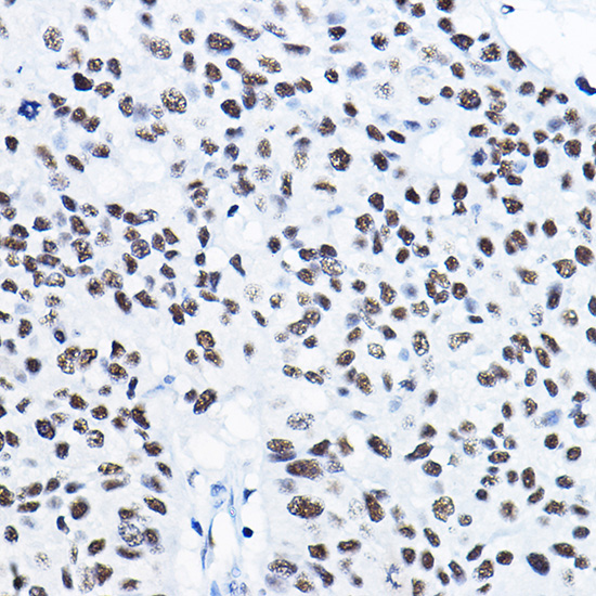 [KD Validated] HDAC1 Rabbit polyclonal antibody