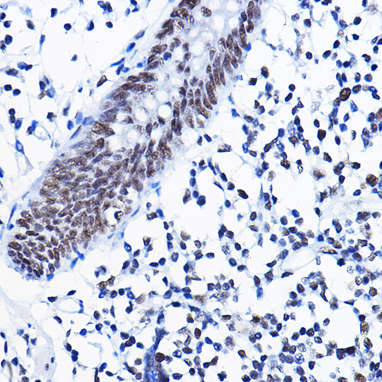 [KD Validated] HDAC1 Rabbit polyclonal antibody