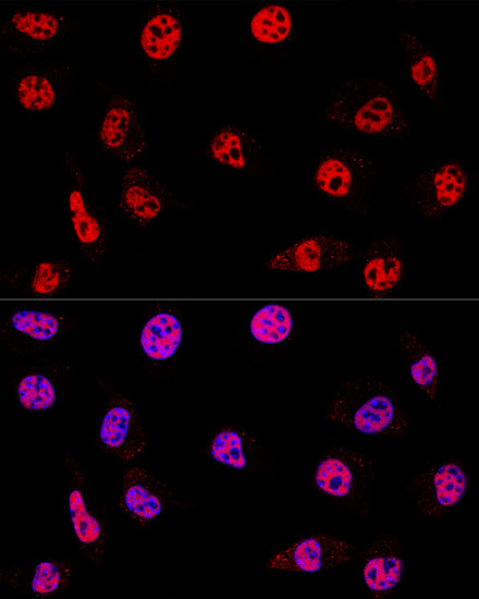 ABclonal:Immunofluorescence - [KO Validated] HDAC1 Rabbit pAb (A0238)}