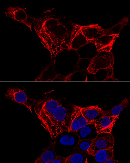 Confocal immunofluorescence analysis of A-431 cells using Cytokeratin 20 (KRT20) Rabbit pAb (A0248) at dilution of 1:200. Blue: DAPI for nuclear staining.