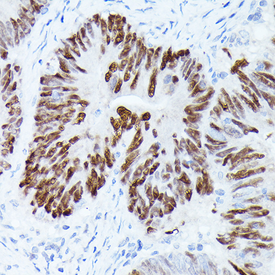 [KO Validated] p53 Rabbit polyclonal antibody