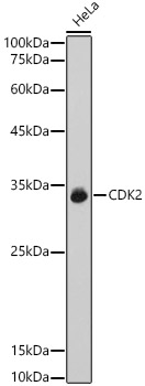 [KO Validated] CDK2 Rabbit polyclonal antibody