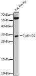 Western blot - Cyclin D1 Rabbit pAb (A0310)