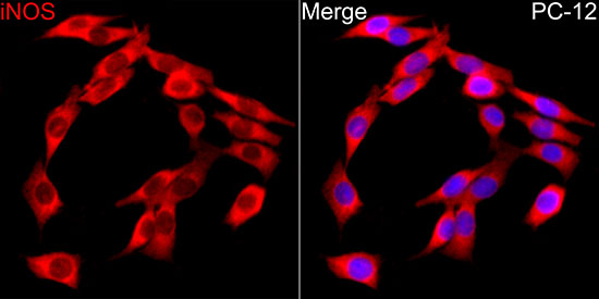 iNOS Rabbit polyclonal antibody