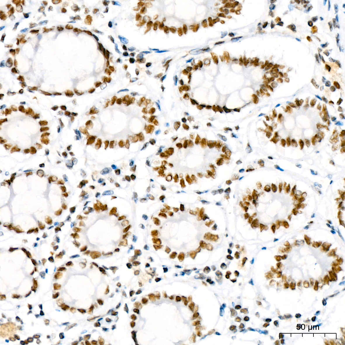 PBRM1 Rabbit monoclonal antibody