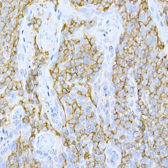 CD44 Rabbit polyclonal antibody