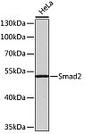 Western blot - Smad2 Rabbit pAb (A0440)
