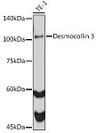 Western blot - Desmocollin 3 Rabbit mAb (A0445)