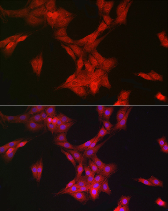 MRPL28 Rabbit monoclonal antibody