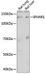 Western blot - IFNAR1 Rabbit mAb (A0575)
