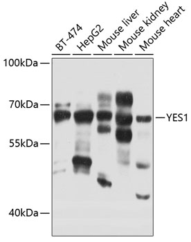 Western blot analysis of various lysates using YES1 Rabbit pAb (A0628) at 1:1000 dilution.<br/>Secondary antibody: HRP-conjugated Goat anti-Rabbit IgG (H+L) (AS014) at 1:10000 dilution.<br/>Lysates/proteins: 25μg per lane.<br/>Blocking buffer: 3% nonfat dry milk in TBST.<br/>Detection: ECL Basic Kit (RM00020).<br/>Exposure time: 20s.