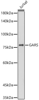 [KO Validated] GARS Rabbit monoclonal antibody