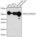 Western blot - MAGE-1/MAGE1A Rabbit mAb (A0723)