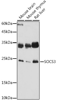 SOCS3 antibody