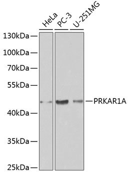 [KO Validated] PRKAR1A Rabbit polyclonal antibody