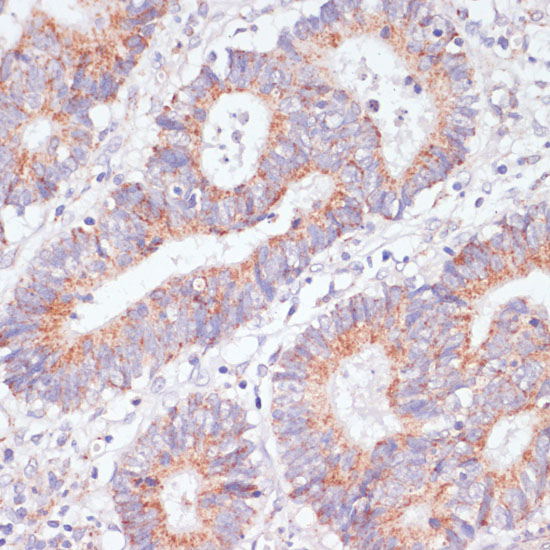 [KO Validated] Rap1A Rabbit polyclonal antibody