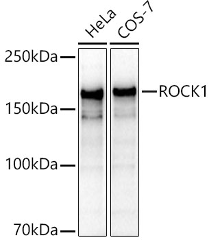 Western blot analysis of various lysates, using [KO Validated] ROCK1 Rabbit pAb (A1008) at 1:1000 dilution.<br/>Secondary antibody: HRP-conjugated Goat anti-Rabbit IgG (H+L) (AS014) at 1:10000 dilution.<br/>Lysates/proteins: 25μg per lane.<br/>Blocking buffer: 3% nonfat dry milk in TBST.<br/>Detection: ECL Basic Kit (RM00020).<br/>Exposure time: 10s.