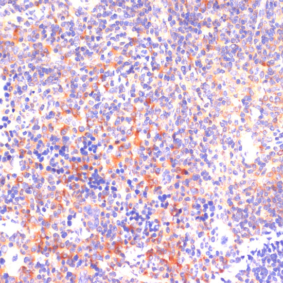 [KO Validated] ROCK1 Rabbit polyclonal antibody