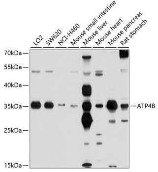 ATP4B Rabbit pAb