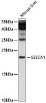 Western blot - SSSCA1 Rabbit pAb (A10137)
