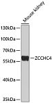 Western blot - ZCCHC4 Rabbit pAb (A10144)