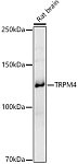 Western blot - TRPM4 Rabbit pAb (A10146)