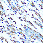 Western blot - DMT1/SLC11A2 Rabbit pAb (A10231)