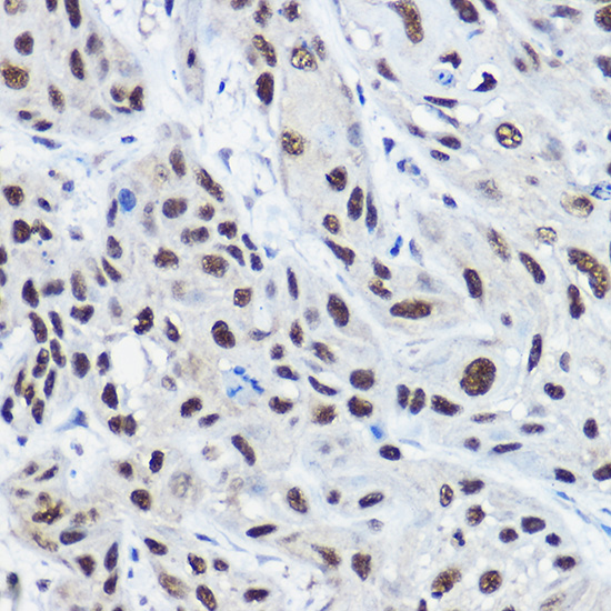 [KO Validated] NCOA2 Rabbit polyclonal antibody