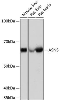 ASNS Rabbit mAb