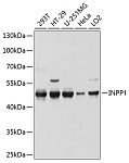 Western blot - INPP1 Rabbit pAb (A10372)