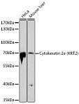Western blot - Cytokeratin 2e (KRT2) Rabbit pAb (A10375)