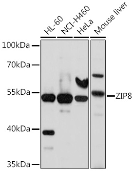 ZIP8 Rabbit pAb