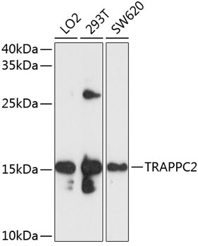 TRAPPC2 Rabbit pAb